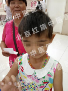 北京红旗中医医院帮助毛发疾病儿童找回七彩童年